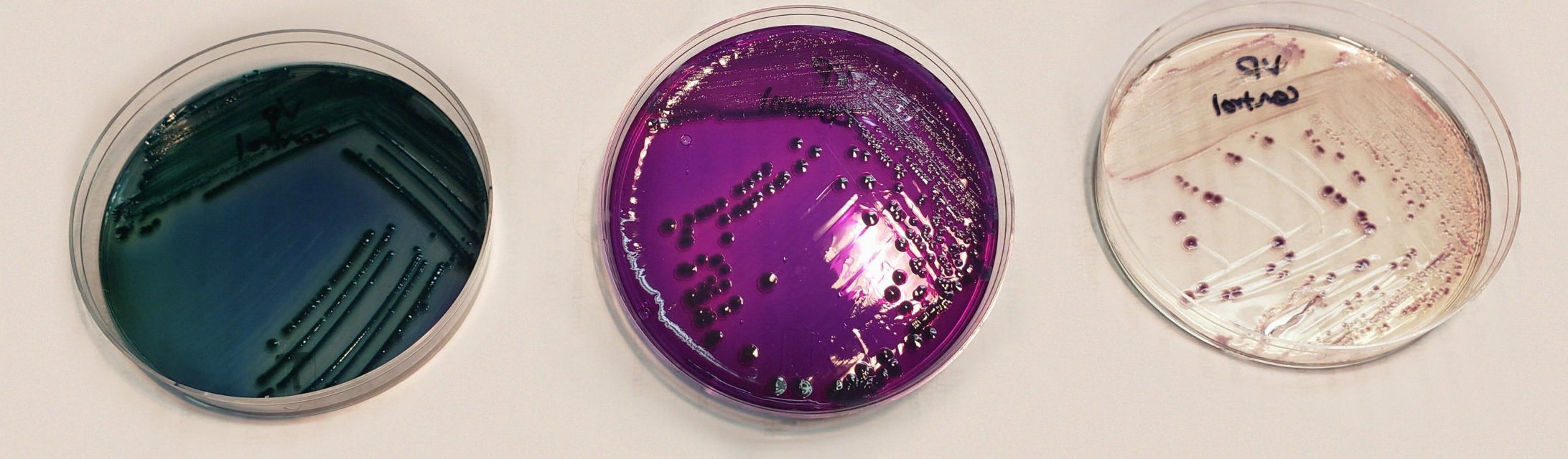 Vibrio parahaemolyticus plate