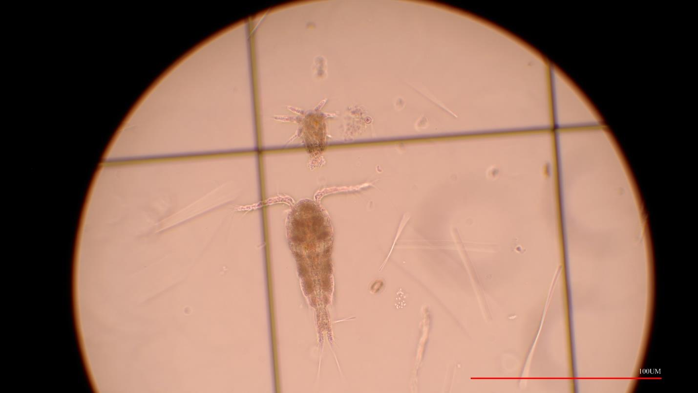 zooplankton