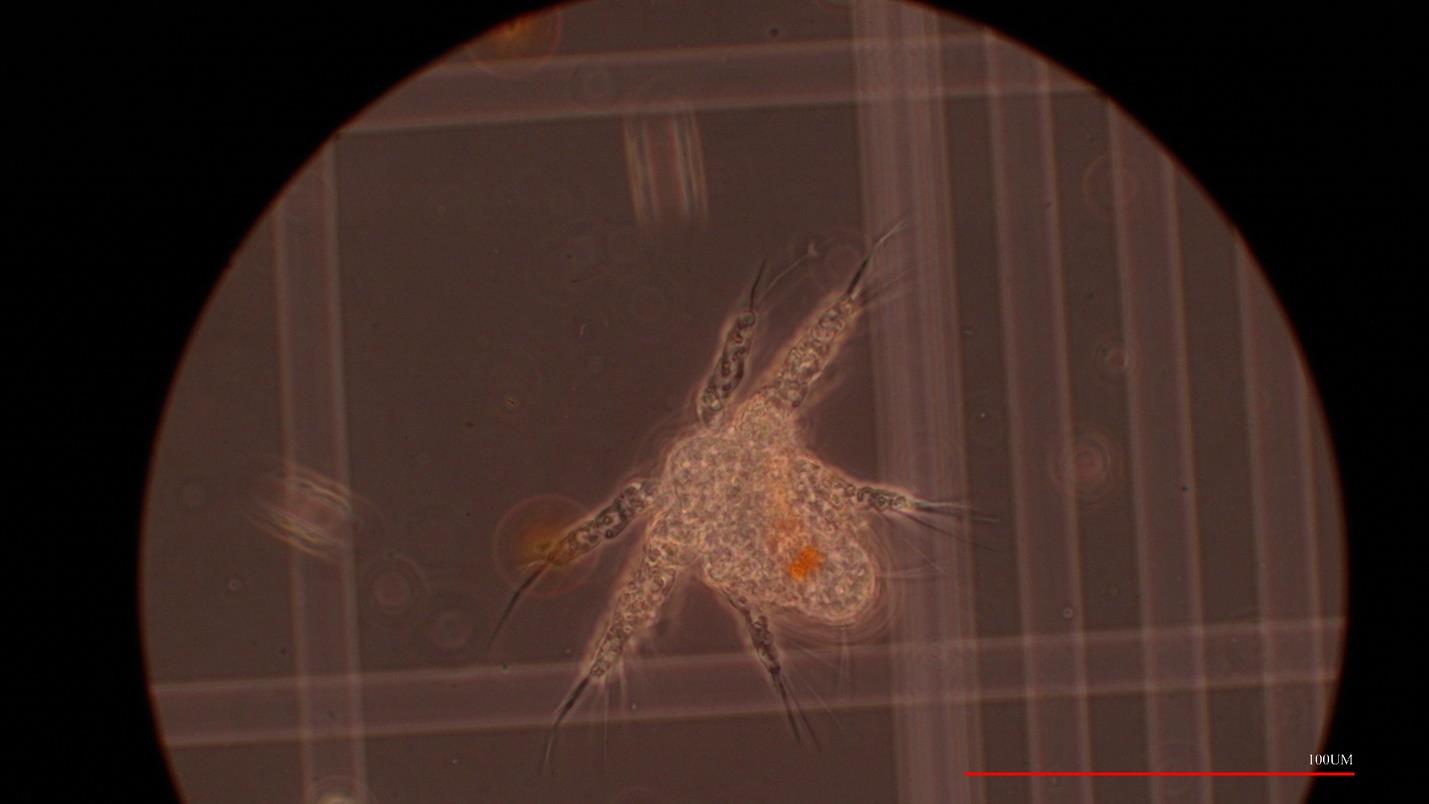 zooplankton