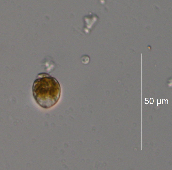 NJDEP| Division of Science and Research | Amphidinium carterae